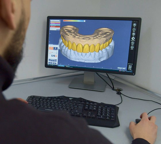 Цифрова точність у сучасному стоматологічному дизайні