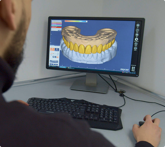 Technician modeling teeth in CAD/CAM software on a monitor